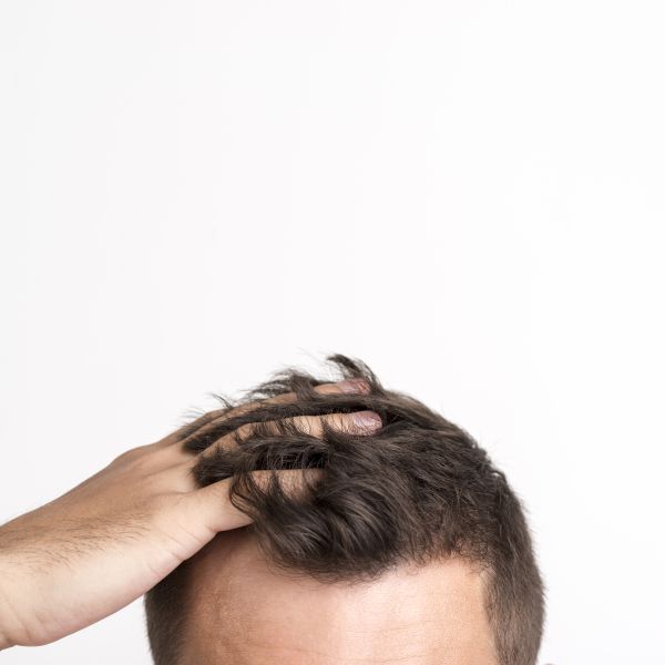 4 důvody, proč kolagen může pomoci s vypadáváním vlasů